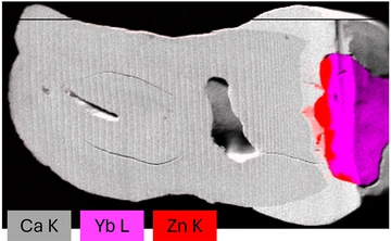 Das Kompositbild aus den Daten der micro-XRF-Analyse zeigt die Verteilung der Elemente Ca, Yb und Zn in einem behandelten menschlichen Zahn © Leona Bauer (TU Berlin/HZB)